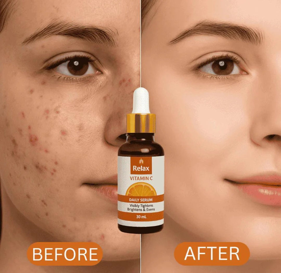 Relax Vitamin C Daily Face Serum – Anti-Aging & Hydrating Formula for Healthy Radiant Skin (30ml)
