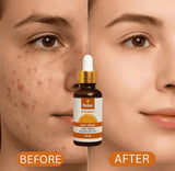 Relax Vitamin C Daily Face Serum – Anti-Aging & Hydrating Formula for Healthy Radiant Skin (30ml)